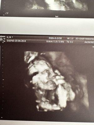 3D 4 Baby Ultrasound Boutique - Mansfield