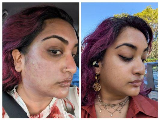 Immediately after vs morning after