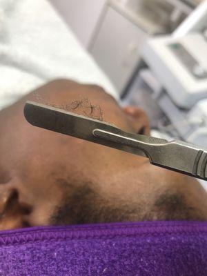 Dermaplaning service