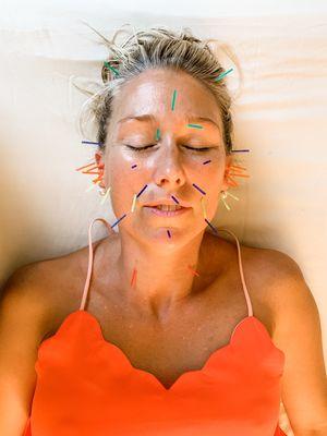Soul and Lune Acupuncture