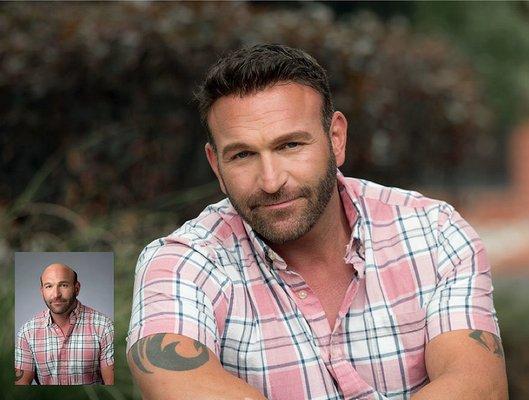 Dermatex Hair Orange County