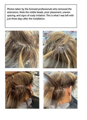 Defective, painful installations that were subsequently and thankfullly removed.