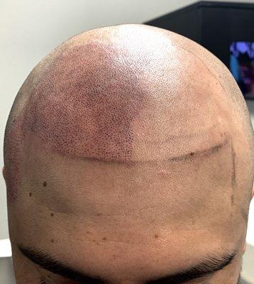 First session in progress.