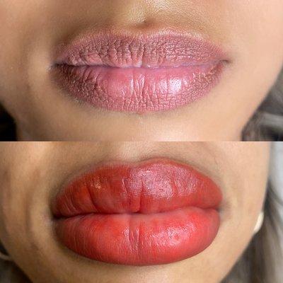 Lip Neutralization