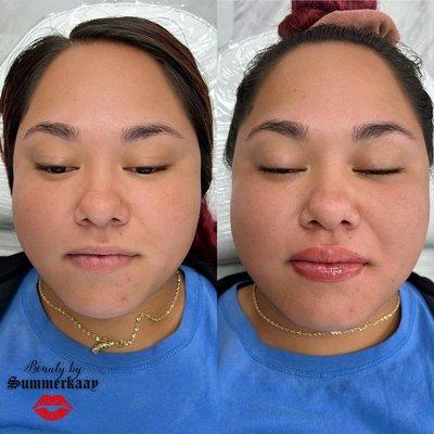 Before & after her 1st lip blush session (natural)