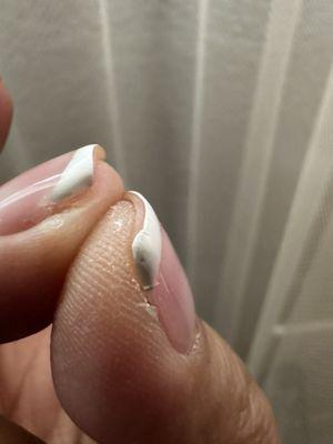1 week after: Both nails have a crack.