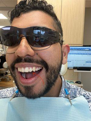 Before the procedure was done.