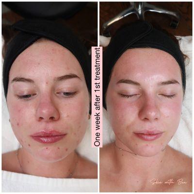 Skin With Bea Esthetics