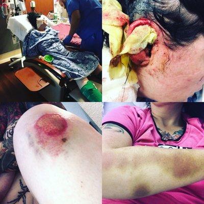 My injuries were significant, but the most damage was done to my brain.