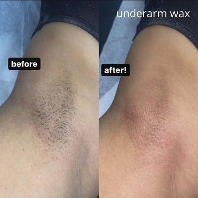 Underarm wax before and after