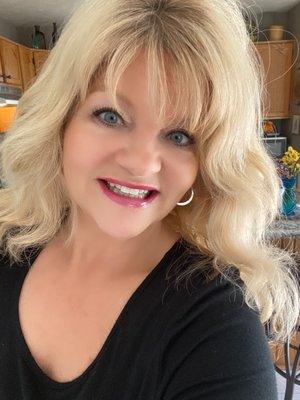 Beautiful front crowns!