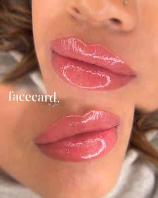 Lip Blush/ Lip Neutralization