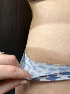 Our double dark solution freshly applied to the skin.