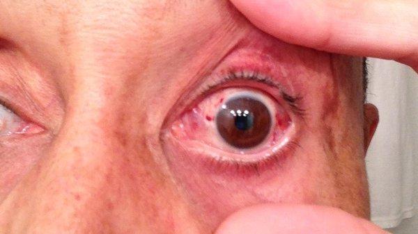 Rappaport Kenneth D MD