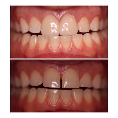 Whittier Emergency & Implant Dentist