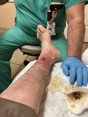 Total Foot and Ankle of Tampa Bay - Brandon