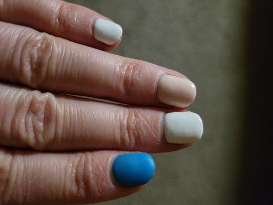 Nails are way too short.