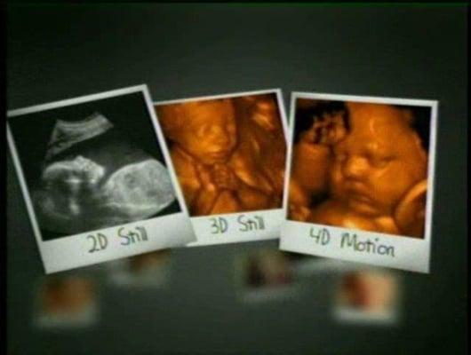 All About Baby Keepsake Ultrasound Studio