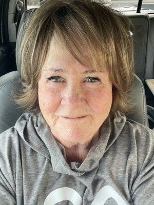 Finally I feel I have my Rosacea is under control. Austin is a gentle soul and educated in all the benefits that Lotus Body Image offers.