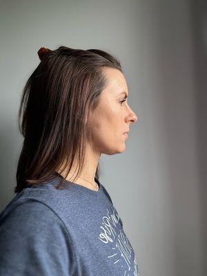 National Hair Loss Medical Aesthetics