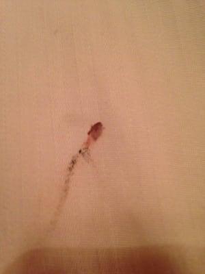 Killed bed bug