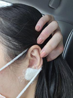 Ear piercing infection