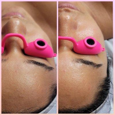 The glow after a facial