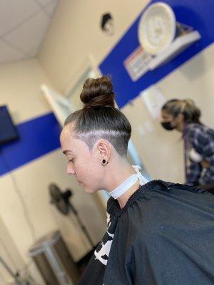 Normal line and undercut