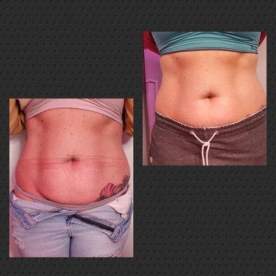 CryoLAB Staten Island