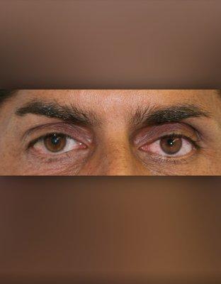 Prosthetic Artists Inc