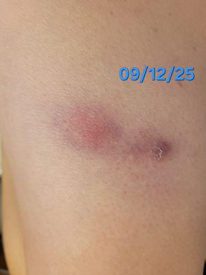 Sidney Smith - Georgia Skin and Cancer