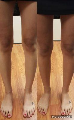 color correction. client went to a game wearing ripped jeans. knees were tanned, used a darker shade, and avoided spraying the knee area
