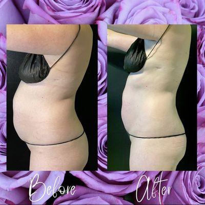 2 Flatter Tummy sessions down!