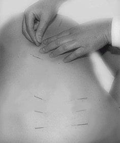 Wellshire Massage & Acupuncture - Cherry Tower