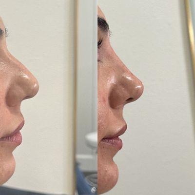 Rumi Aesthetics - Newport Beach