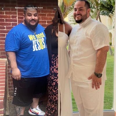 Center For Weight Loss Surgery