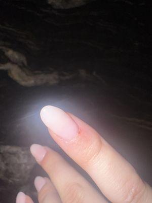 Terrible nail shape and a cut