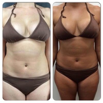 Key Biscayne Spray Tan