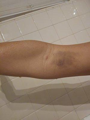 BioLife Plasma Services