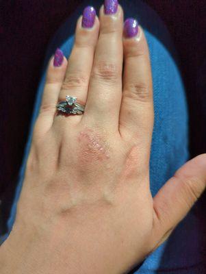 Associated Hand Surgeons