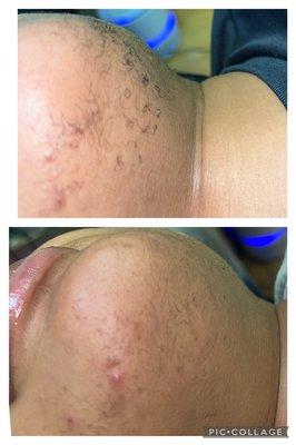 Hair thinning over time