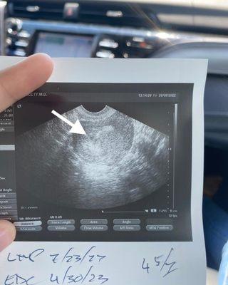 Arizona Center For Reproductive Endocrinology & Infertility