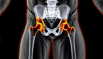 Davis Orthopaedics - Mark B Davis, DO