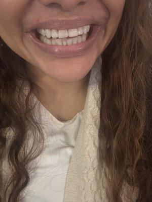 Oh, hello beautiful smile