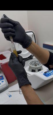 Preparing PRF (Platelet-Rich Fibrin) -- a natural, regenerative treatment using your own biology to enhance skin and hair health.