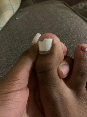 I got my toes done a couple weeks again and it's burning bad don't get your nails or toes done . When the lady lay the acrylic it burns