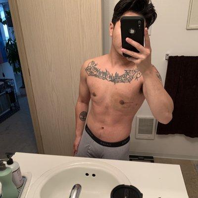 Olympic Plastic Surgery Center