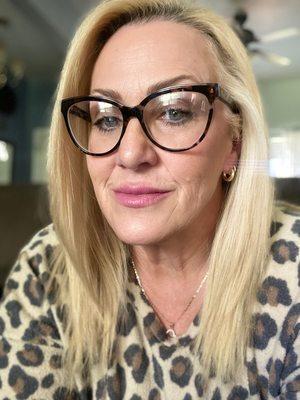 Electrolysis by Chamaine