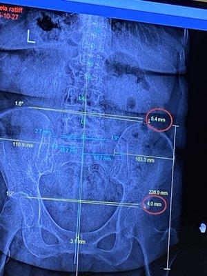 Randal Crabtree - Chiro Plus Clinics