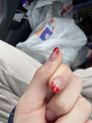 The thumb is missing acrylic on part of it because she didn't know what she was doing.